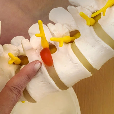 Chiropractic Comfort TX Painful Disc Diagram